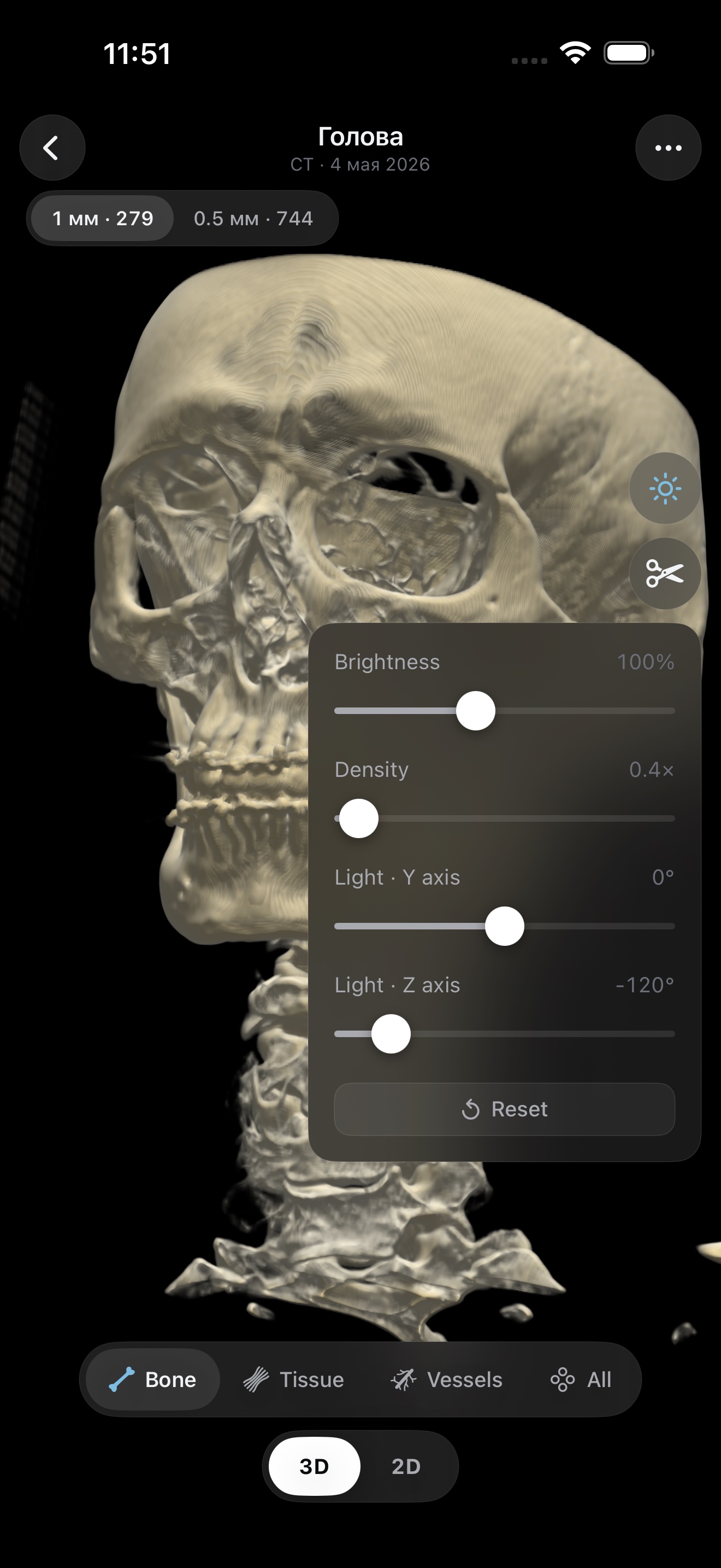 3D skull, bone preset, with adjustments panel