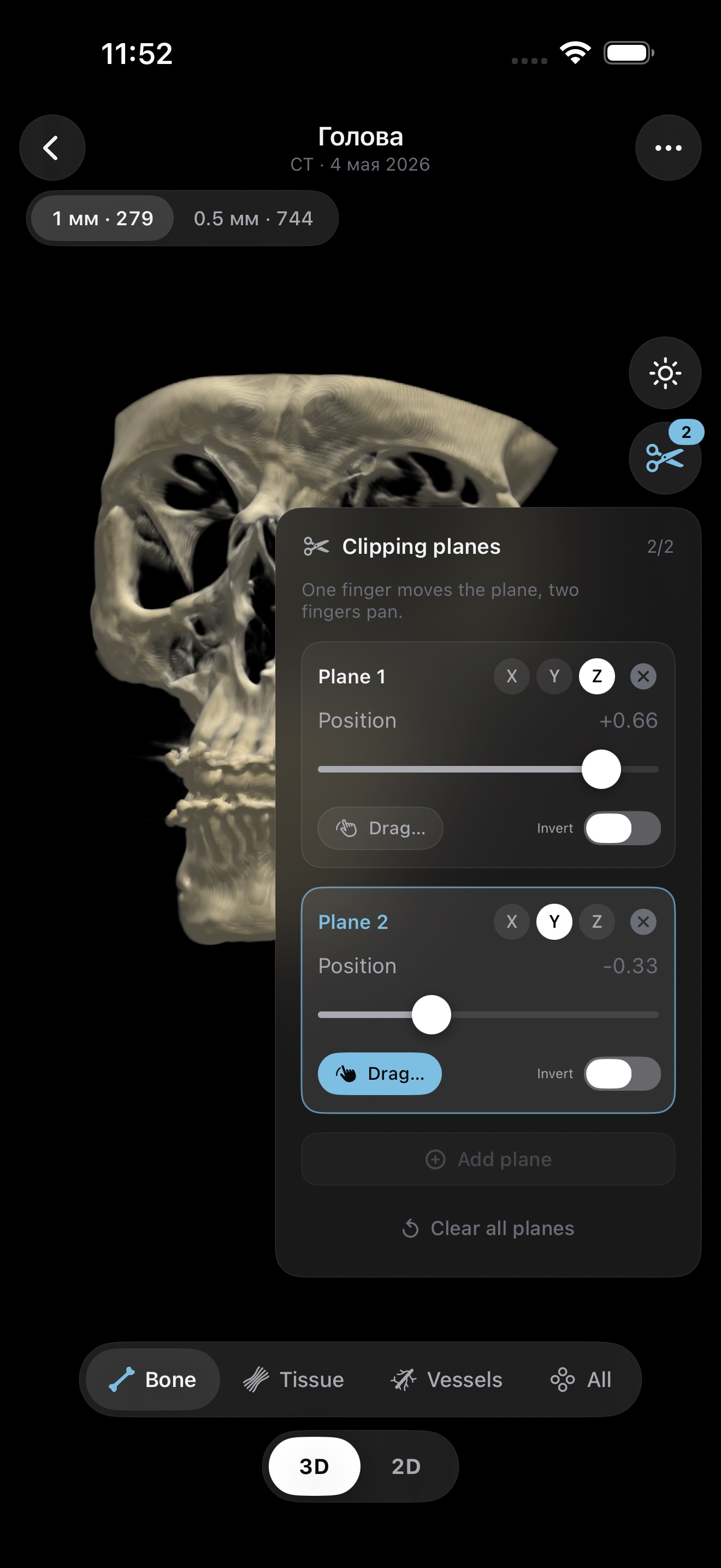3D skull with clipping planes panel