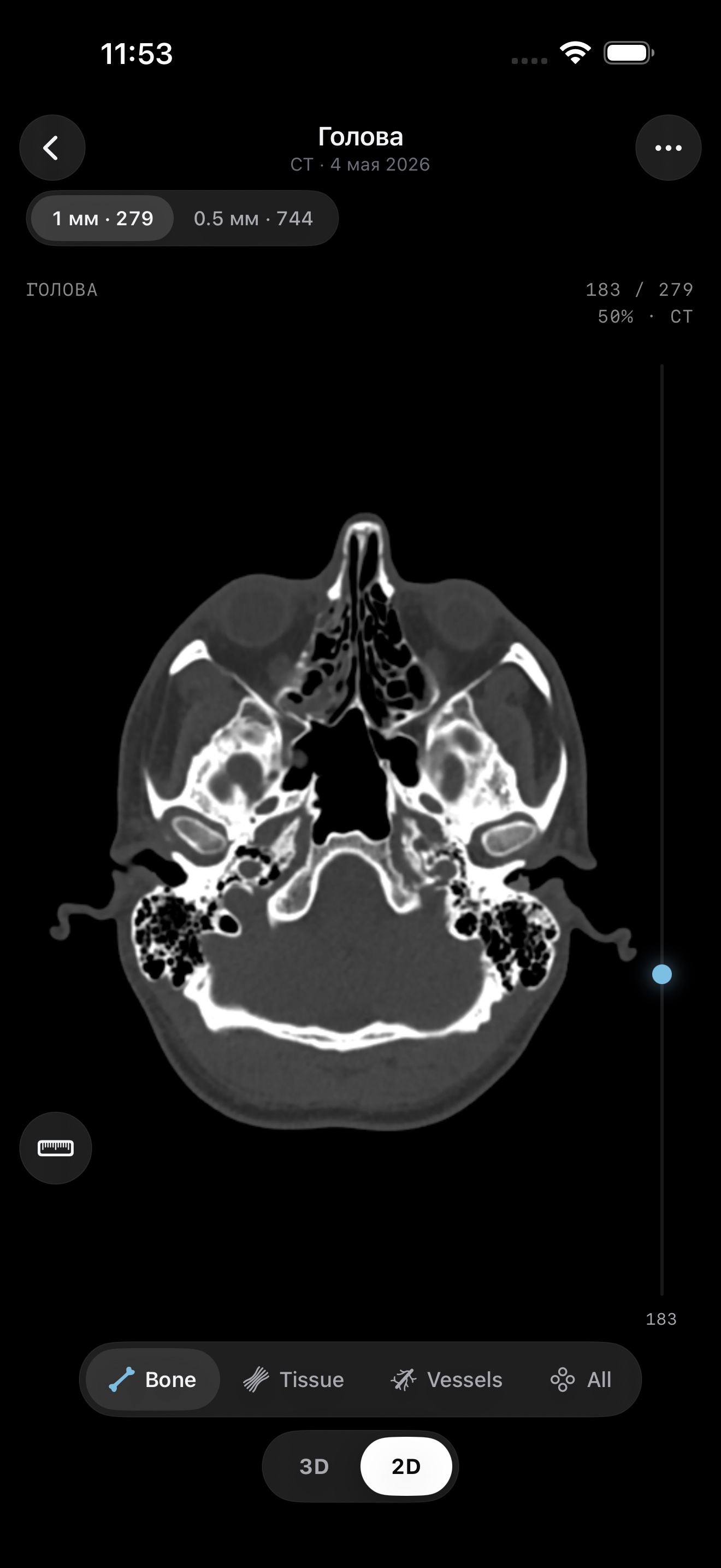 2D CT slice of the head
