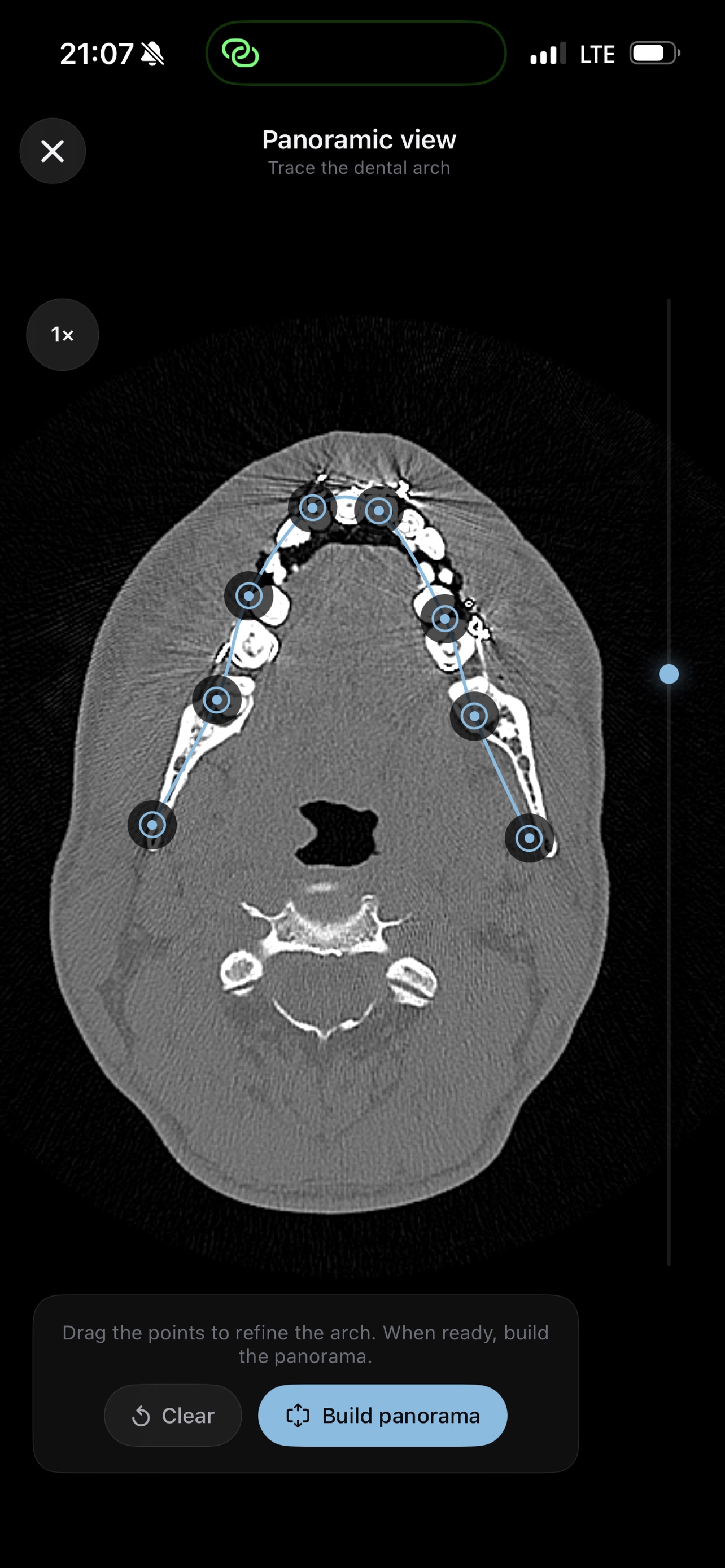 Panoramic view — tracing the dental arch on an axial CT slice